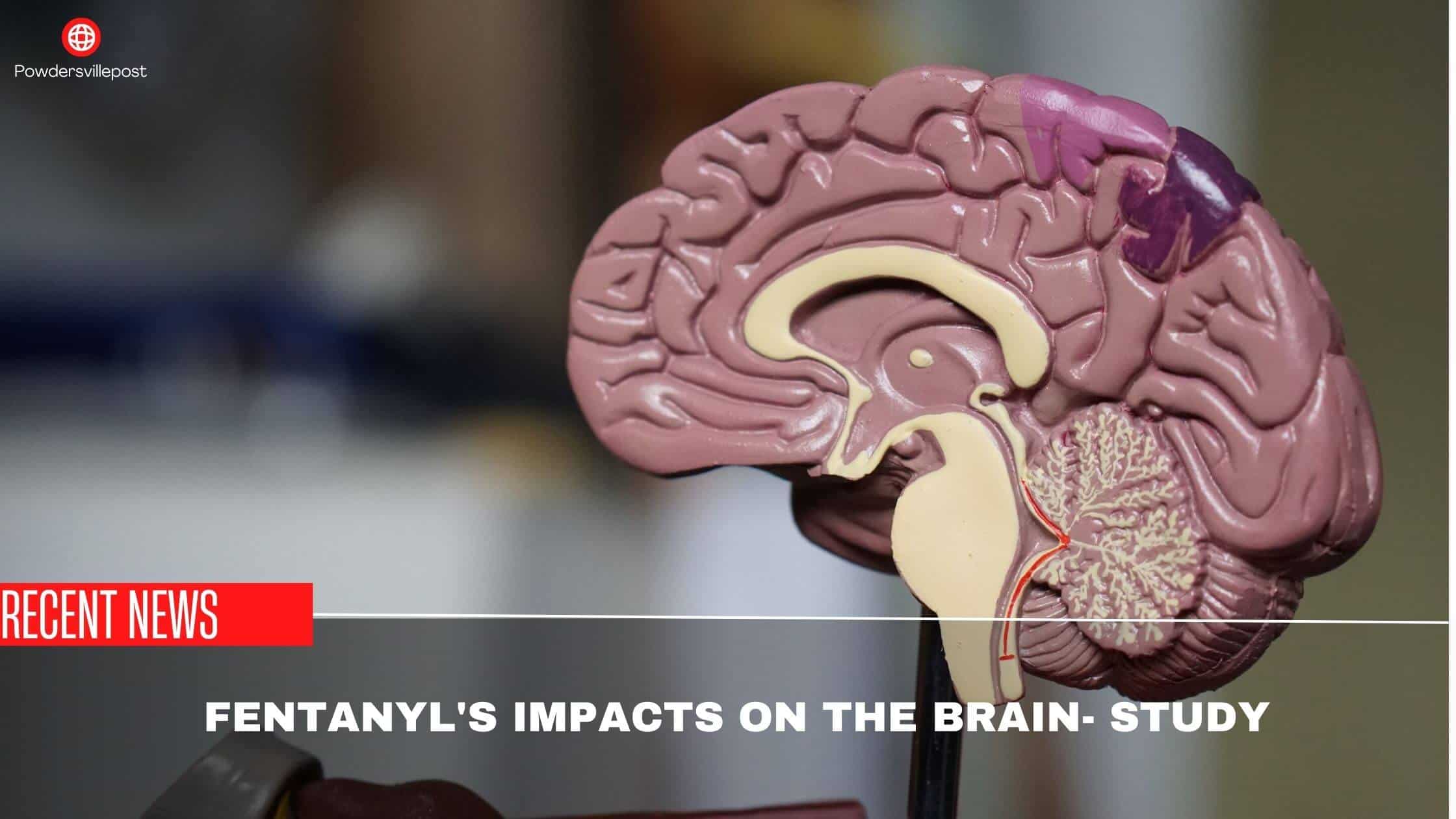 Fentanyl's Impacts On The Brain- Study