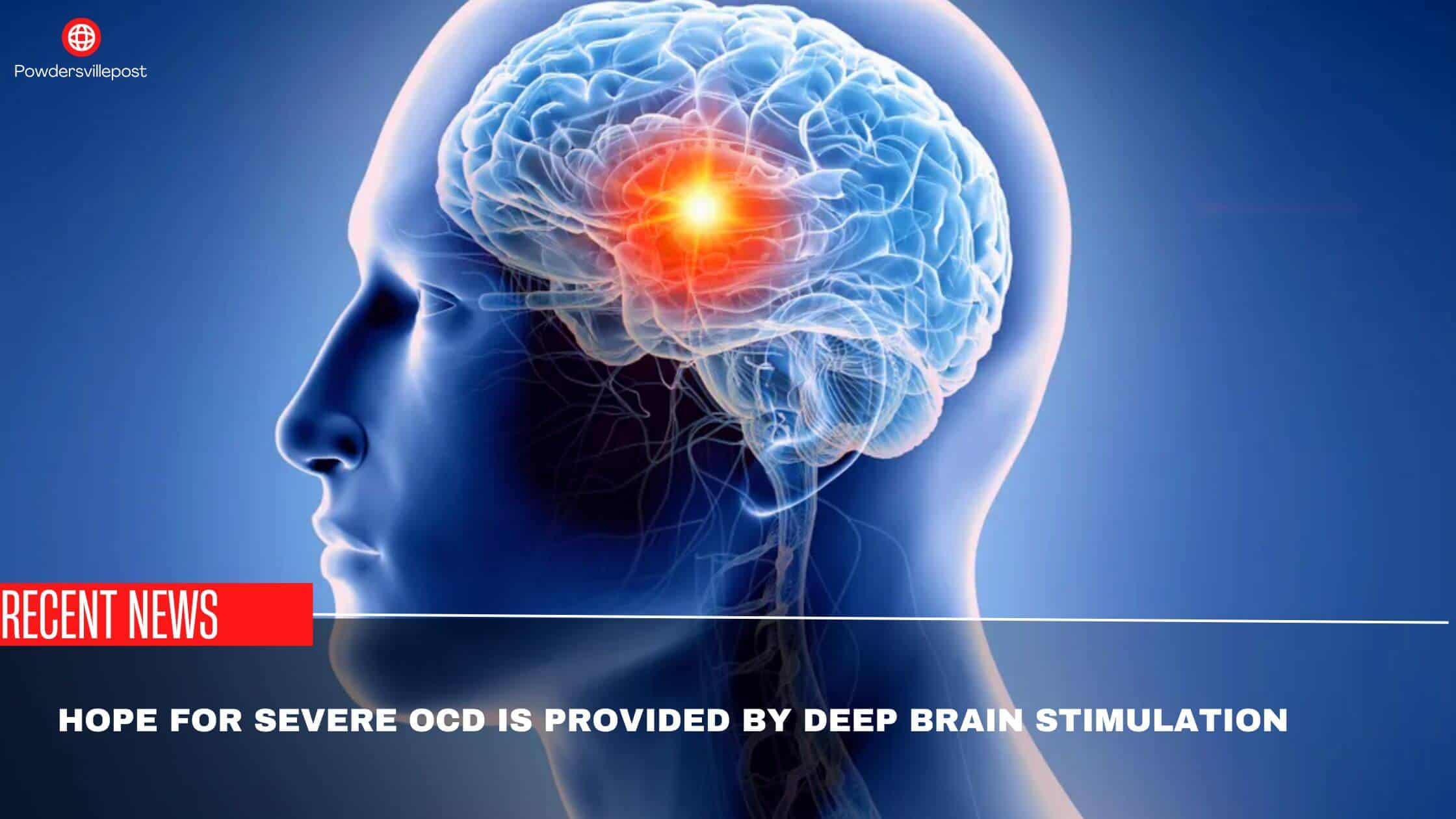 Hope For Severe OCD Is Provided By Deep Brain Stimulation