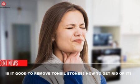 Is It Good To Remove Tonsil Stones How To Get Rid Of It