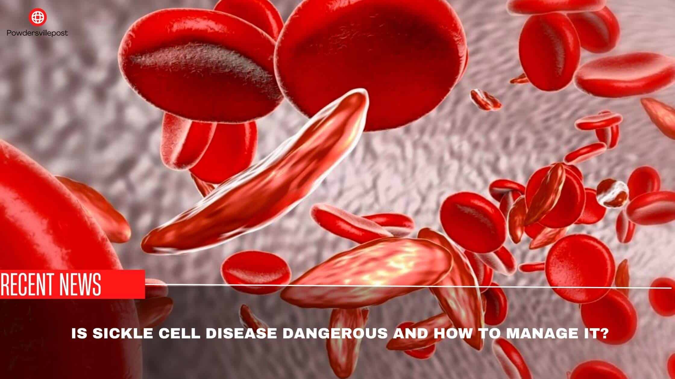 Is Sickle Cell Disease Dangerous And How To Manage It