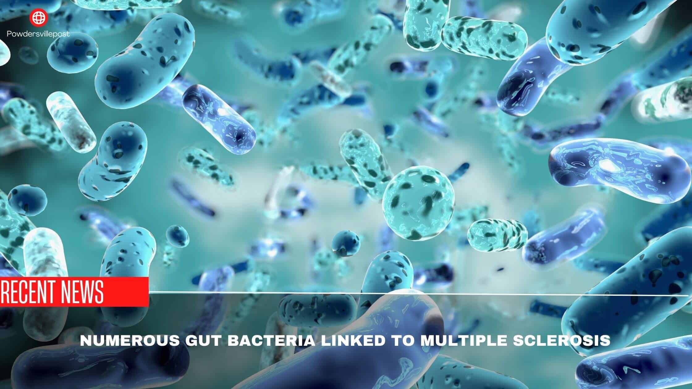 Numerous Gut Bacteria Linked To Multiple Sclerosis- Scientist's Findings