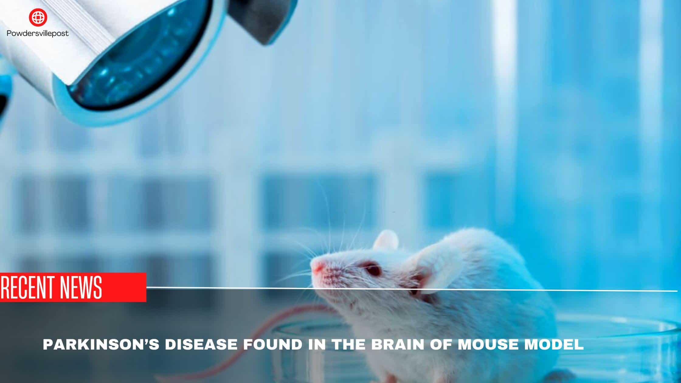 Parkinson’s Disease Found In The Brain Of Mouse Model -Study