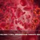 RR Multiple Myeloma T-cell Redirection Therapy Shows Promise