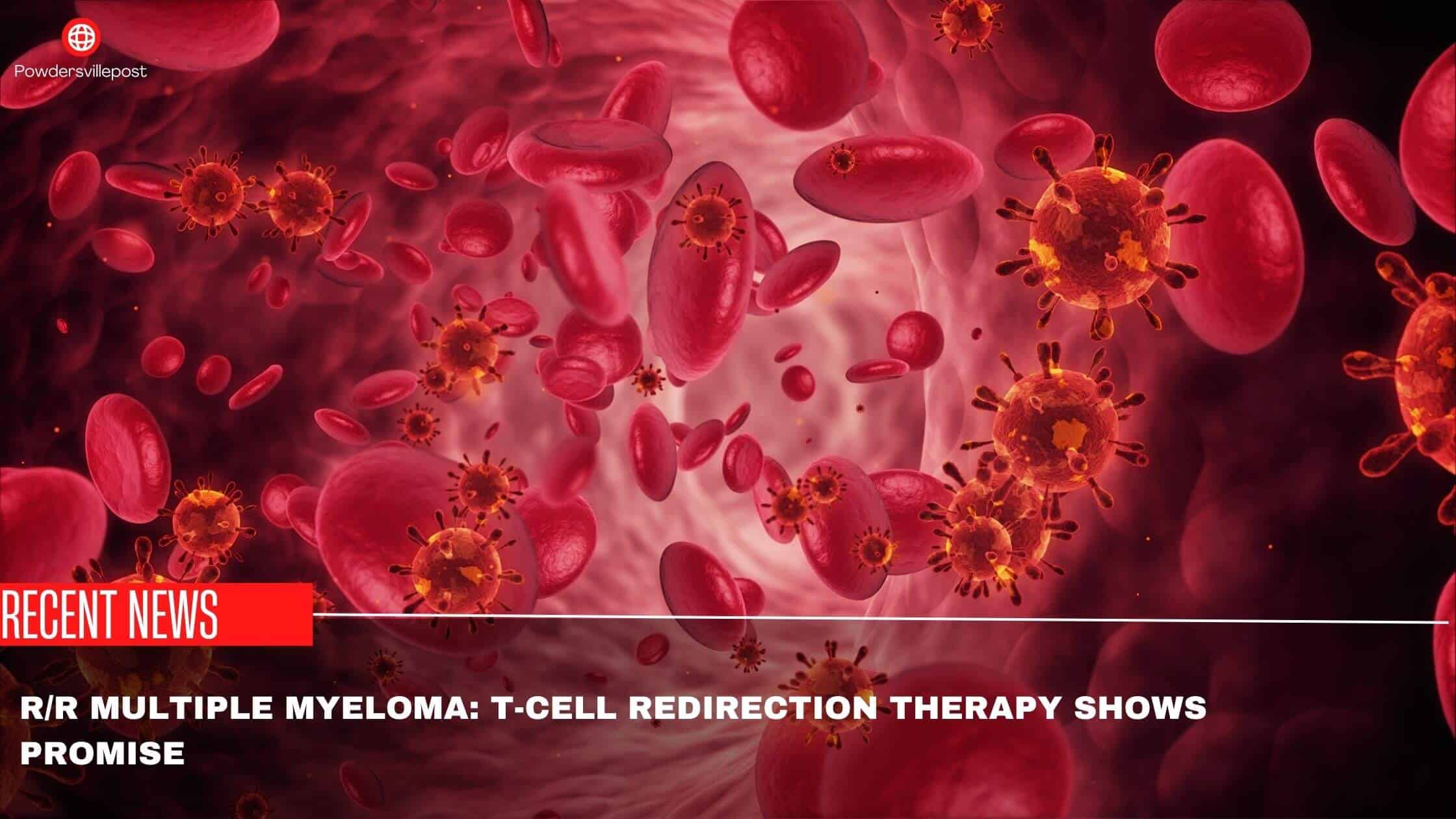 RR Multiple Myeloma T-cell Redirection Therapy Shows Promise