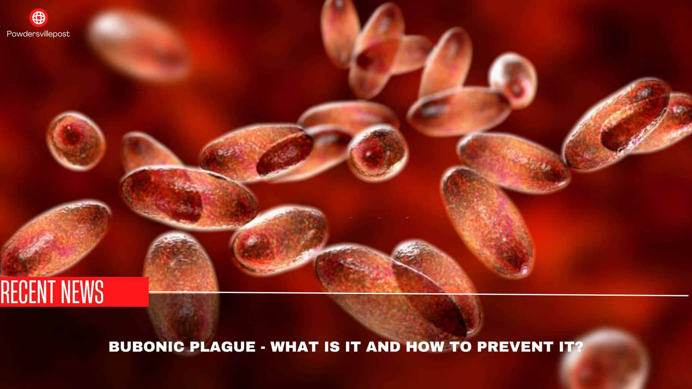 Bubonic Plague - What Is It And How To Prevent It