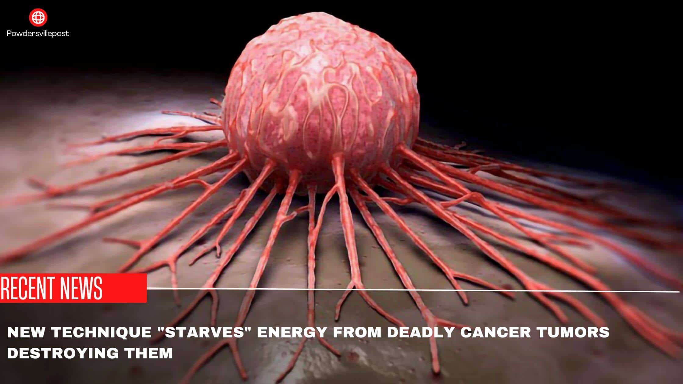 New Technique Starves Energy From Deadly Cancer Tumors Destroying Them