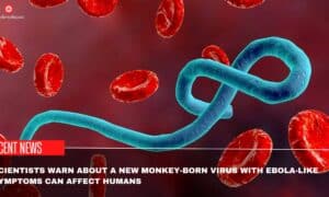 Scientists Warn About A New Monkey-Born Virus With Ebola-Like Symptoms Can Affect Humans