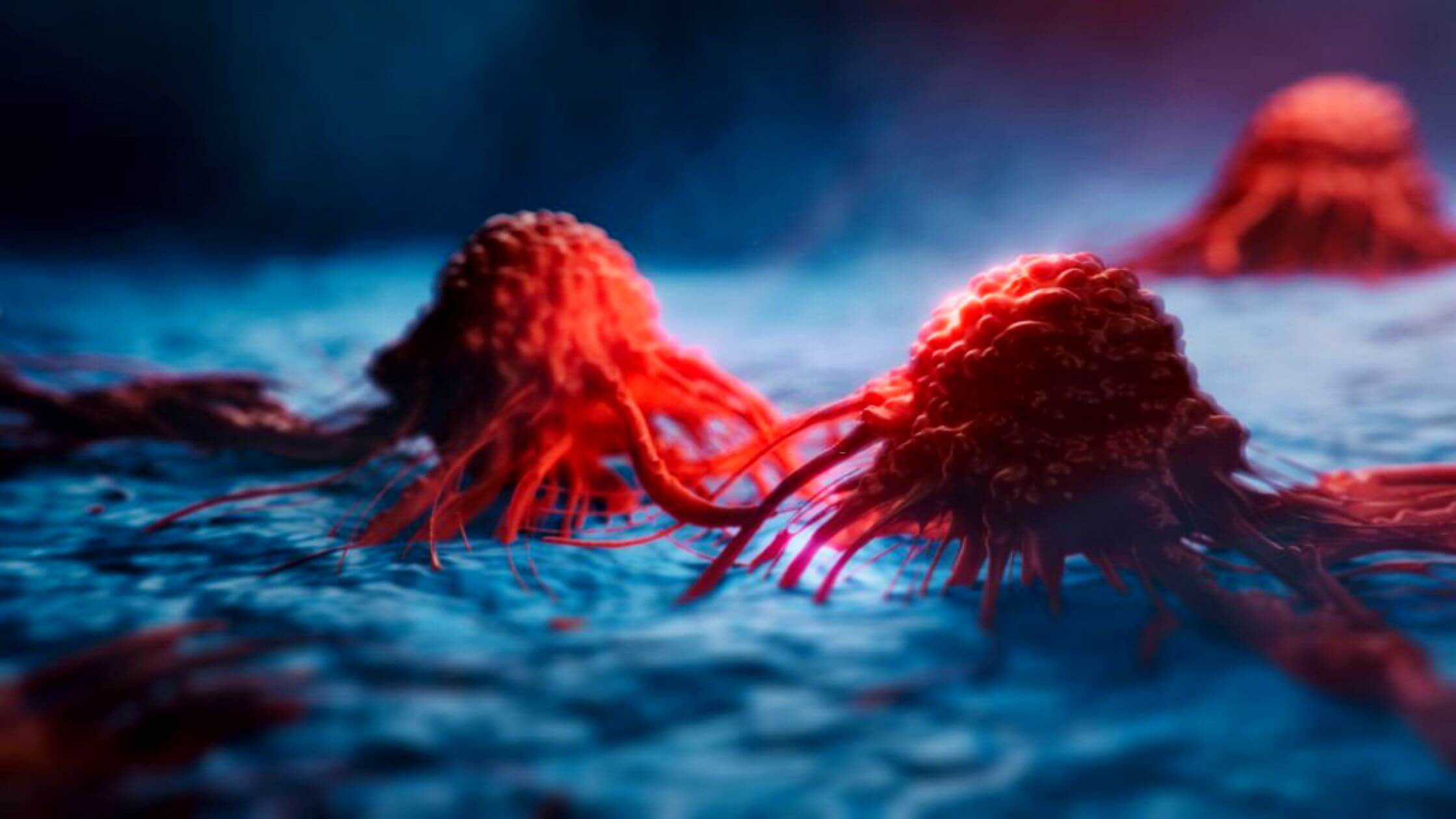 New Technique "Starves" Energy From Deadly Cancer Tumors Destroying Them