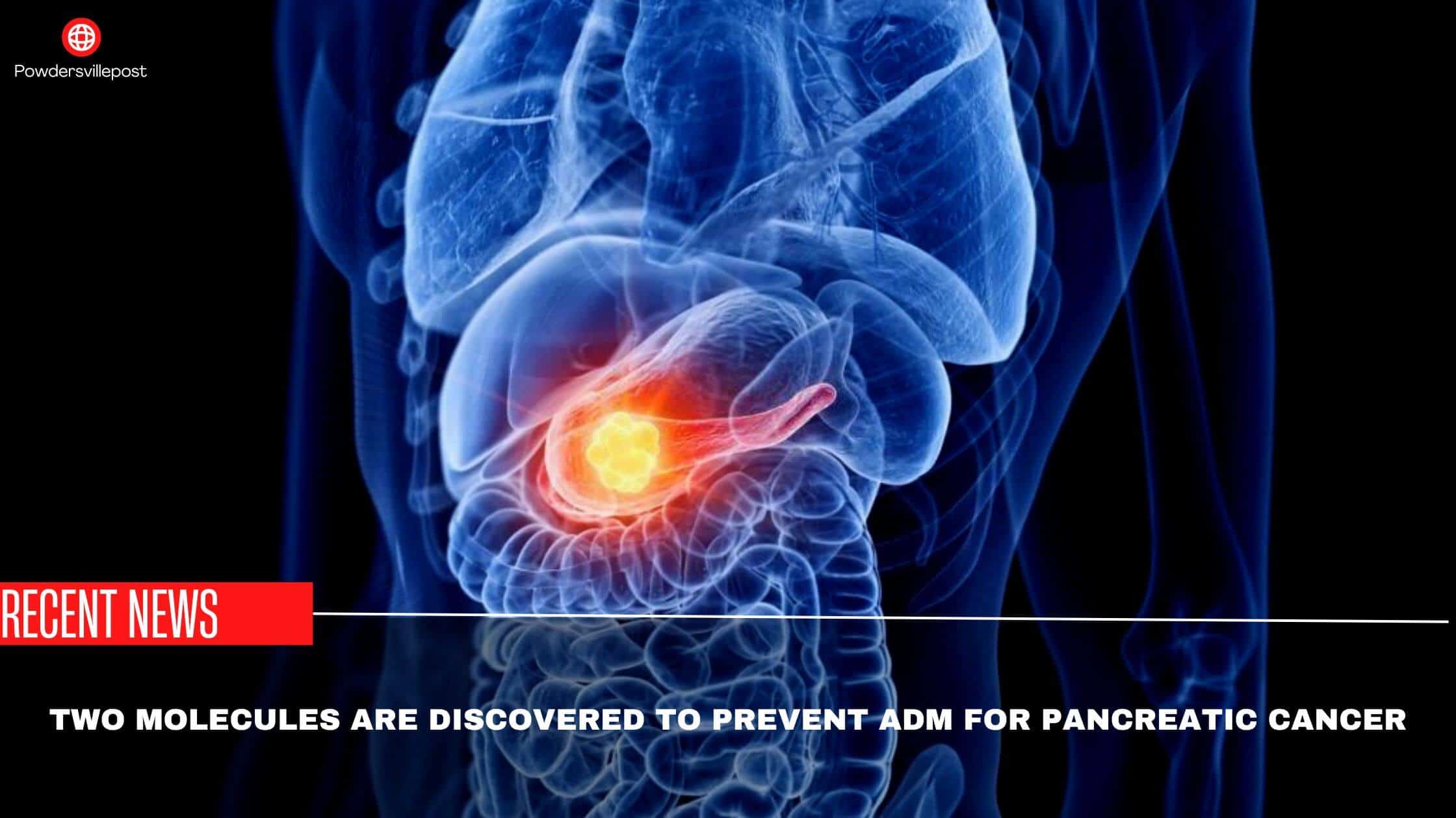 Two Molecules Are Discovered To Prevent ADM For Pancreatic Cancer