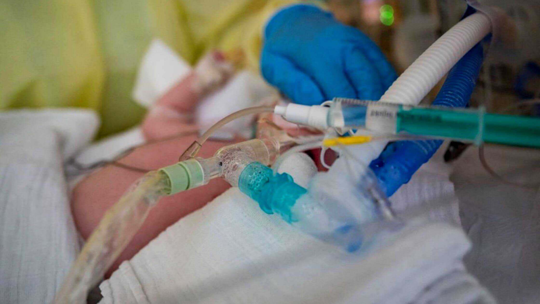 A Child Of 4 Dies From RSV-Related Illness In Riverside County