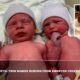 Magical Birth Twin Babies Reborn From Embryos Frozen 30 Years Ago
