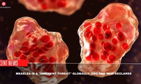 Measles Is A Imminent Threat Globally CDC And WHO Declares
