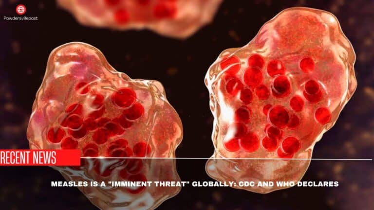 Measles Is A “Imminent Threat” Globally: CDC And WHO Declares