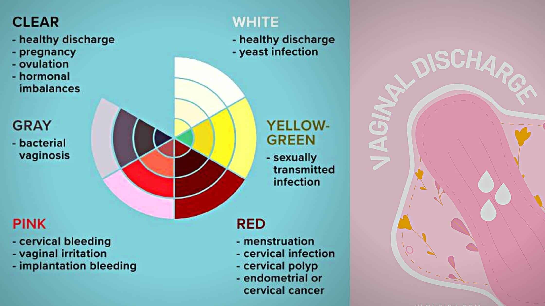 vaginal-discharge-guide-with-color-code-sexiz-pix