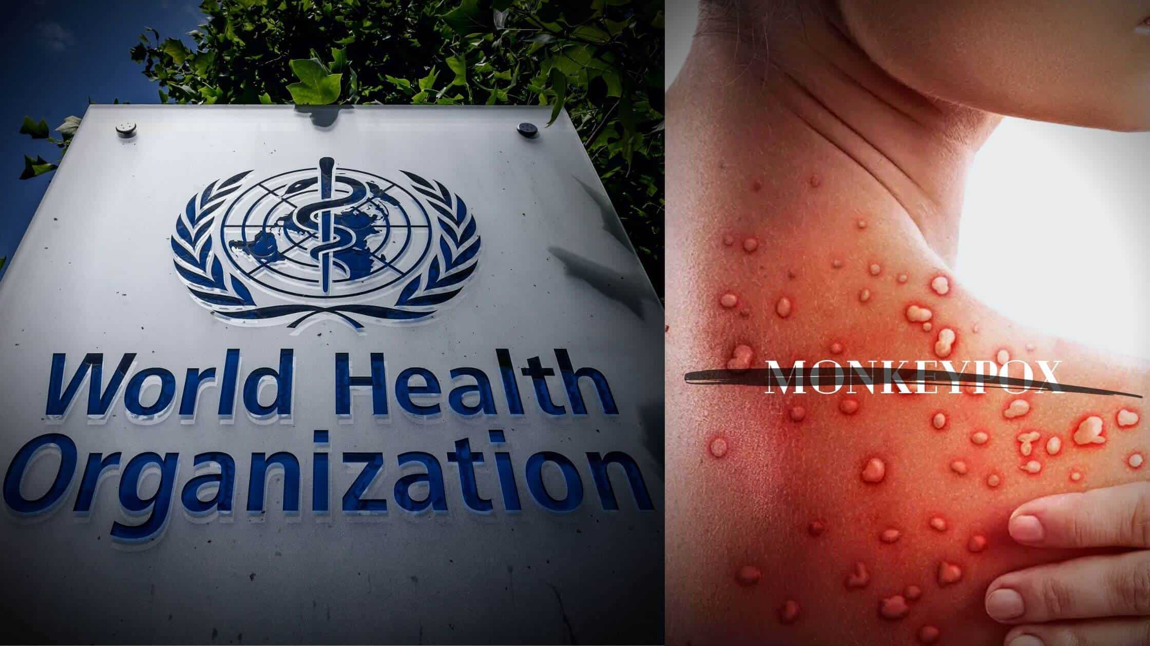 In Response To Racial Concerns, The Who Renames Monkeypox To Mpox